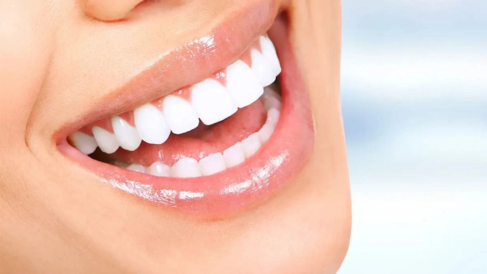 Gülüş Tasarımı (Hollywood Smile)